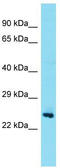 Testis Expressed 36 antibody, TA334884, Origene, Western Blot image 