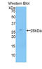 Serine Protease 8 antibody, LS-C296078, Lifespan Biosciences, Western Blot image 