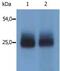 Linker For Activation Of T Cells Family Member 2 antibody, PA1-19442, Invitrogen Antibodies, Western Blot image 