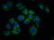 HAS1 antibody, LS-C671809, Lifespan Biosciences, Immunofluorescence image 