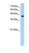 Acyl-CoA Dehydrogenase Long Chain antibody, NBP1-54936, Novus Biologicals, Western Blot image 