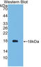 Vascular Endothelial Growth Factor-121 antibody, LS-C374251, Lifespan Biosciences, Western Blot image 