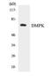 DM1 Protein Kinase antibody, EKC1781, Boster Biological Technology, Western Blot image 