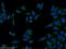Proteasome 26S Subunit, Non-ATPase 2 antibody, 14748-1-AP, Proteintech Group, Immunofluorescence image 