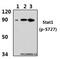 Signal Transducer And Activator Of Transcription 1 antibody, A00036S727-1, Boster Biological Technology, Western Blot image 