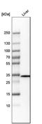 Thiosulfate Sulfurtransferase antibody, HPA003643, Atlas Antibodies, Western Blot image 