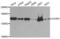 Cell Division Cycle And Apoptosis Regulator 1 antibody, abx004842, Abbexa, Western Blot image 
