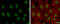 AT-Rich Interaction Domain 2 antibody, GTX129443, GeneTex, Immunofluorescence image 