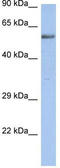 Zinc Finger Protein 513 antibody, TA329330, Origene, Western Blot image 