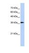 ATPase H+ Transporting V0 Subunit D2 antibody, NBP1-54857, Novus Biologicals, Western Blot image 