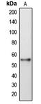 Gasdermin E antibody, LS-B13572, Lifespan Biosciences, Western Blot image 