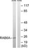 RAB6A, Member RAS Oncogene Family antibody, TA313064, Origene, Western Blot image 