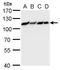 DNA replication licensing factor MCM6 antibody, GTX129216, GeneTex, Western Blot image 