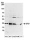 D-Aminoacyl-TRNA Deacylase 1 antibody, A304-671A, Bethyl Labs, Western Blot image 