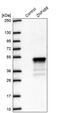 Zinc Finger Protein 488 antibody, PA5-60852, Invitrogen Antibodies, Western Blot image 