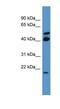 RERG antibody, NBP1-68972, Novus Biologicals, Western Blot image 