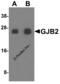Gap Junction Protein Beta 2 antibody, 8031, ProSci, Western Blot image 