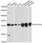 ATPase H+ Transporting V1 Subunit B2 antibody, A3754, ABclonal Technology, Western Blot image 