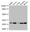 Quinoid Dihydropteridine Reductase antibody, A63254-100, Epigentek, Western Blot image 