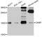 Cathelicidin Antimicrobial Peptide antibody, A1640, ABclonal Technology, Western Blot image 
