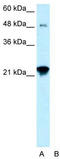 Ceramide Synthase 2 antibody, TA329695, Origene, Western Blot image 