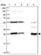 Sepiapterin Reductase antibody, PA5-58819, Invitrogen Antibodies, Western Blot image 