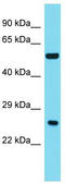 Ankyrin Repeat Domain 18A antibody, TA334824, Origene, Western Blot image 
