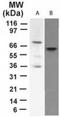 Tumor Protein P73 antibody, TA337049, Origene, Western Blot image 