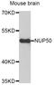 Nuclear pore complex protein Nup50 antibody, STJ111702, St John