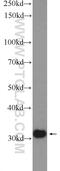 Small Nuclear Ribonucleoprotein Polypeptide A antibody, 10212-1-AP, Proteintech Group, Western Blot image 