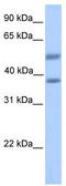 ST6 N-Acetylgalactosaminide Alpha-2,6-Sialyltransferase 2 antibody, TA335687, Origene, Western Blot image 