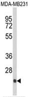 Derlin 2 antibody, AP17988PU-N, Origene, Western Blot image 