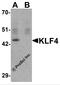 Kruppel Like Factor 4 antibody, PM-6141, ProSci, Western Blot image 