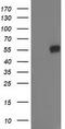 Glucosylceramidase Beta 3 (Gene/Pseudogene) antibody, TA502675, Origene, Western Blot image 