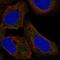 Forkhead box protein E1 antibody, NBP2-57736, Novus Biologicals, Immunocytochemistry image 
