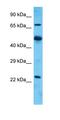 Alpha Tubulin Acetyltransferase 1 antibody, orb325026, Biorbyt, Western Blot image 