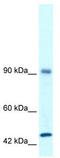 RNA Binding Motif Protein 10 antibody, TA329113, Origene, Western Blot image 