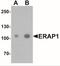 A-LAP antibody, NBP2-41232, Novus Biologicals, Western Blot image 