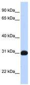 Nuclear Receptor Subfamily 0 Group B Member 2 antibody, TA338003, Origene, Western Blot image 