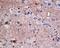 ATP Citrate Lyase antibody, M02372, Boster Biological Technology, Immunohistochemistry paraffin image 