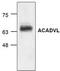 Very long-chain specific acyl-CoA dehydrogenase, mitochondrial antibody, TA318885, Origene, Western Blot image 