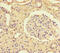 Sst2 antibody, CSB-PA022725LA01HU, Cusabio, Immunohistochemistry paraffin image 