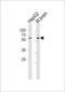 Terminal Nucleotidyltransferase 2 antibody, 61-789, ProSci, Western Blot image 