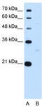 TEF Transcription Factor, PAR BZIP Family Member antibody, TA343376, Origene, Western Blot image 