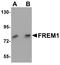 FRAS1 Related Extracellular Matrix 1 antibody, A09605, Boster Biological Technology, Western Blot image 