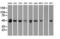 Small RNA Binding Exonuclease Protection Factor La antibody, LS-C114530, Lifespan Biosciences, Western Blot image 