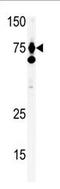 Hepatocyte Growth Factor antibody, AP11675PU-N, Origene, Western Blot image 