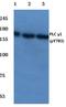 Phospholipase C-gamma-1 antibody, A00677Y783, Boster Biological Technology, Western Blot image 