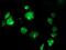 Signal Sequence Receptor Subunit 1 antibody, MA5-25605, Invitrogen Antibodies, Immunocytochemistry image 