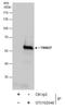 Zinc finger protein RFP antibody, GTX102048, GeneTex, Immunoprecipitation image 